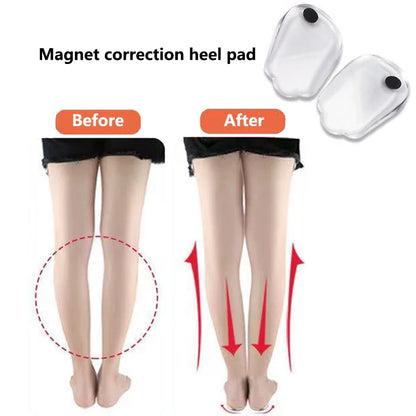 Magnets Silicon Orthopedic Insoles Legs Knee Varus Correction Heel Pads